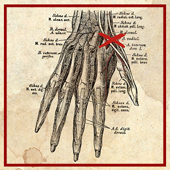 Bieten eine Möglichkeit mehr als gedacht: Die Arterien am Handrücken (Abb. aus "Die descriptive und topographische Anatomie des Menschen" von Carl Heitzmann, 1870)